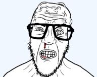blood brain clenched_teeth glasses gums soyjak stubble variant:nerdjak vein // 713x567 // 16.3KB