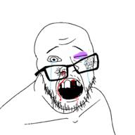 beaten black_eye blood broken_glasses broken_teeth crying hurt missing_teeth mustache open_mouth sad soyjak stubble teeth variant:feraljak // 1500x1500 // 335.9KB