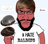 balding beard glasses hair i_hate norwood punisher_face red_skin subvariant:science_lover text variant:markiplier_soyjak // 1017x935 // 756.1KB