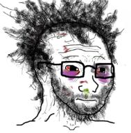 blood bloodshot_eyes glasses hair mucus soyjak stubble tired variant:wojak // 840x854 // 544.2KB