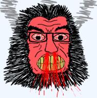 angry beard blood bloodshot_eyes clenched_teeth fume glasses hair red_face soyjak variant:soydoz yellow_teeth // 600x610 // 1.4MB