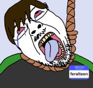 ack bloodshot_eyes feralteen glasses name_tag open_mouth rope soyjak suicide variant:bernd // 768x719 // 42.5KB