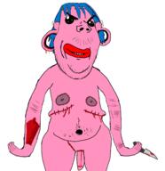 blood blue_hair deep_wound exposed_muscle frankenpenis ftm masectomy masectomy_scars navel pink_skin pooner scar self_harm stitches stubble surgery top_surgery variant:gapejak // 1356x1403 // 395.5KB