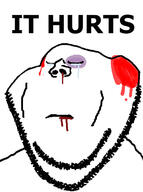black_eye blood closed_eyes crying its_over soyjak stubble text variant:impish_soyak_ears // 479x641 // 60.0KB