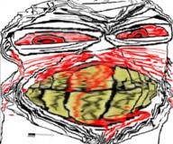 angry blood bloodshot_eyes clenched_teeth distorted ear glasses nosebleed red_eyes soyjak stubble subvariant:feralrage variant:feraljak yellow_teeth // 666x555 // 770.4KB