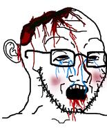 blood blood_on_face bloodshot_eyes blush crying ear glasses gore guro meta:gore soyjak tear variant:soyak wound // 644x800 // 61.5KB