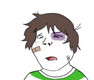 bandage beaten black_eye blood brown_hair bruise clothes crying drool soyjak subvariant:shoyta variant:gapejak // 1012x861 // 24.5KB