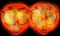 2soyjaks crooked_teeth deformed glasses space stubble subvariant:tornadojak sun twins variant:volcanojak // 1332x799 // 968.6KB