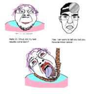 2soyjaks bloodshot_eyes cancer closed_mouth crying doctor ear eyelashes glasses hair hanging head_mirror heart i_love mustache open_mouth purple_hair rope smile soyjak stubble suicide tongue tranny variant:bernd variant:chudjak yellow_teeth // 747x786 // 211.2KB