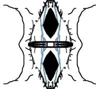 angry crying distorted flipped variant:soyak // 785x730 // 64.9KB