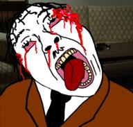 ack adolf_hitler blood blood_drip blood_from_eyes blood_on_face bloodshot_eyes clothes crying death deep_wound exposed_brain gunshot_wound hair looking_up nazism necktie nosebleed open_mouth soyjak suicide suit suit_and_tie tongue tongue_out variant:bernd world_war_2 yellow_teeth // 767x733 // 494.6KB