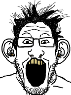 booger dandruff dirty ear ear_hair ear_wax eye_boogers forehead_lines hair looking_at_you meta:variant_get nose_hair open_mouth soyjak stubble variant:markiplier_soyjak white_background yellow_teeth // 600x800 // 30.6KB