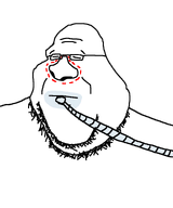 anesthesia bald body closed_eyes closed_mouth double_chin fat forehead_wrinkles glasses nose nose_surgery sleeping stubble subvariant:tony_jakprano surgery variant:impish_tony // 800x959 // 11.5KB