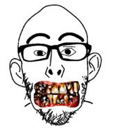 ear glasses missing_teeth soyjak stubble variant:nojak yellow_teeth you_were_one_i_ker // 886x1046 // 243.6KB