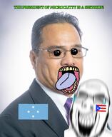 clothes cuba_vs_puerto_rico flag:micronesia flag:puerto_rico geg glasses microclitty_vs_puerto_rico mouth_open mutt oh_my_god_she_is_so_attractive puerto_rico rotten_teeth shitskin suit text tongue_out variant:cobson yellow_teeth // 1920x2354 // 722.9KB