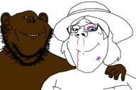 arm bbc beaten blood bruise clothes dress glasses hand hat injured nosebleed soyjak stubble subvariant:gapejak_female subvariant:wholesome_soyjak variant:gapejak variant:impish_soyak_ears // 1500x1000 // 142.3KB