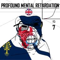 angry bald bell_curve black_eyes black_hole black_sclera british bull clenched_teeth closed_mouth country cow cracked_teeth drool ear england flag flag:oxfordshire flag:united_kingdom glasses hair iq iq_bell_curve mustache nightmare_fuel no_pupils oxfordshire profound_mental_retardation retard soyjak stubble text tree united_kingdom variant:feraljak wrinkles // 1024x1024 // 158.7KB