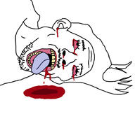 4cuck ack assassination blood bloodshot_eyes dead donald_trump oc op_is_a_retarded_lazy_faggot_for_not_tagging_his_own_shit open_mouth tongue trump_(soyjak_party) variant:bernd yellow_teeth // 947x804 // 167.8KB