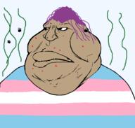 acne braptoko closed_mouth fat flies hair lips purple_hair shitoko shitskin stinky template trans transgender_flag transparent_background variant:meximutt // 1332x1273 // 332.3KB
