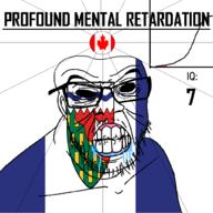 angry bald black_eyes black_hole black_sclera canada clenched_teeth closed_mouth country cracked_teeth drool ear flag flag:canada flag:northwest_territories glasses iq iq_bell_curve mustache nightmare_fuel no_pupils northwest_territories profound_mental_retardation retard soyjak stubble text variant:feraljak wrinkles // 1024x1024 // 82.0KB