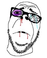 beaten blood blood_drip blood_from_mouth blood_on_face broken_glasses broken_teeth bruise bruised_eye closed_mouth crying frown glasses head_only injury missing_teeth nosebleed sad soyjak stubble teeth variant:dubbbzjak white_background // 702x869 // 17.9KB