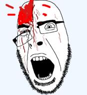blood fucked glasses head sad shocked stubble variant:cobson wound // 721x789 // 25.9KB