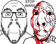 2soyjaks bandage blood brimmiest_comments_section☣️☣️☣️_do_not_enter☣️☣️☣️ glasses hand looking_at_you mustache no_more_brother_wars smile stubble text variant:fisheyejak variant:flartson // 1024x801 // 185.6KB