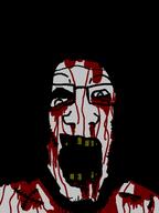 bleed blood glasses horror open_mouth rotten_teeth rotting rotting_teeth stitches stubble subvariant:neutralplier variant:markiplier_soyjak yellow_teeth // 600x800 // 59.8KB