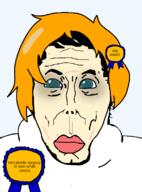 asian award korea plastic_surgery scar scars south_korea subvariant:asiamutt subvariant:koreamutt surgery text variant:markiplier_soyjak wig yellow_skin // 590x796 // 78.9KB