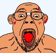 beard blood ear glasses mouth_open soyjak teeth tongue variant:bernd // 1024x959 // 226.0KB