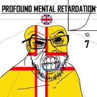 angry bald bell_curve black_eyes black_hole black_sclera british clenched_teeth closed_mouth country cracked_teeth dorset drool ear england flag flag:dorset flag:united_kingdom glasses hair iq iq_bell_curve mustache nightmare_fuel no_pupils profound_mental_retardation retard soyjak stubble text united_kingdom variant:feraljak wrinkles // 1024x1024 // 47.6KB