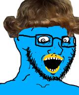 acne beak blue_skin crazed glasses hair insane soyjak subvariant:soyak_(crazed) variant:soyak xitter xitter_immigrant // 665x800 // 295.0KB