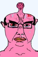 angry bloodshot_eyes brainlet crying pink_skin variant:chudjak vein yellow_teeth // 392x590 // 58.9KB