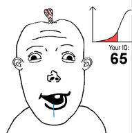 brainlet downs_syndrome dumb iq low_iq no_glasses no_stubble retard retarded small_brain stupid transparent_background variant:vlodson // 1019x1025 // 107.6KB