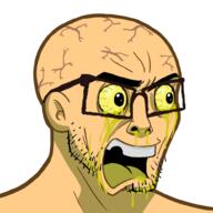 blood bloodshot_eyes ear open_mouth soyjak stubble variant:nujak yellow yellow_sclera yellow_skin // 1000x1000 // 484.3KB