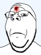bald blood blood_drip blood_from_forehead blood_on_face bullet_hole crying death frown glasses gunshot_wound injury looking_at_you restoration sad series:soyjak_restoration_project soyjak stubble subvariant:wholesome_soyjak tragedyjakking transparent_background variant:gapejak // 600x800 // 38.1KB