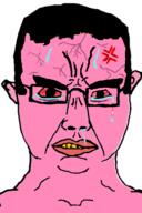 anger_mark bloodshot_eyes ear glasses hair mucus pink_skin soyjak subvariant:chudjak_front sweating variant:chudjak vein yellow_teeth // 392x590 // 31.8KB