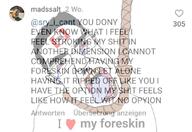 bloodshot_eyes crying ear foreskin glasses goyim_defense_league hair hanging heart i_love mustache open_mouth rope soyjak subvariant:chudjak_front suicide text tongue variant:chudjak yellow_teeth // 1080x742 // 134.8KB