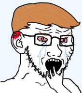 bleed blood bloodshot_eyes crying donald_trump ear meta:tagme variant:soyak wound // 708x800 // 40.7KB