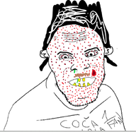 acne coca_cola hair looking_at_you meta:barely_a_soyjak soyjak teeth variant:feraljak // 592x578 // 125.6KB