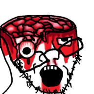 blood blood_drip blood_from_forehead blood_from_mouth bloodshot_eyes brain dangling_eye death deep_wound exposed_bone exposed_brain gore looking_up mutilation nosebleed nsfl open_mouth scalping soyjak stubble variant:soyak white_background // 400x400 // 69.5KB