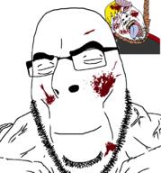 baby blood blood_on_face bloodshot_eyes buff closed_eyes deformed gore hanging hurt nate natejak sharty shartycuck soyjak soyjak_party subvariant:nathaniel variant:cobson variant:gapejak // 721x773 // 91.1KB