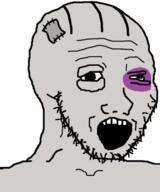 beaten grey_skin open_mouth soyjak stubble variant:soyak vatnik // 427x512 // 128.8KB