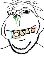 blood cross_eyed drool mouth_closed mucus retard smile subvariant:retarded_gapejak subvariant:wholesome_soyjak variant:gapejak yellow_teeth // 600x800 // 19.5KB