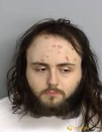 acne beard hair meta:namefags moonmetropolis_(user) series:irl_soyjaks subvariant:chudjak_front template variant:chudjak variant:goldberg video // 448x576, 8.5s // 527.8KB