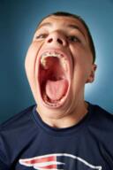 braces gape isaac_johnson new_england_patriots open_mouth proto-soyjak t_shirt teen teeth template tongue variant:isaac // 460x690 // 315.9KB