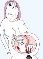 2soyjaks abortion arm baby blood breasts child daddy's_girl death female full_body glasses hand leg medium_breasts meta:pornographic_content naked nipple nsfw painted_nails pregnant scared scissors smile soyjak stubble subvariant:gapejak_female subvariant:soyak_(concerned) subvariant:wholesome_soyjak variant:gapejak variant:soyak // 793x1089 // 178.1KB