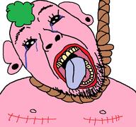 ack meta:leaky meta:tagme pooner rope scars surgery variant:bernd // 768x719 // 36.3KB