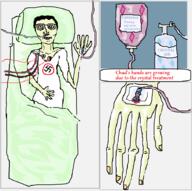 anorexia bed closed_mouth clothes crystal deviantart dying gem glasses hair hospital intravenous_drip nasal_cannula nazism redraw sick soyjak swastika text variant:chudjak yellow_skin // 908x902 // 63.8KB