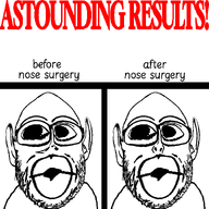before_after big_lips deformed ear glasses looking_to_the_left nose_surgery red_text small_nose soyjak subvariant:nogoblin text variant:nojak white_background white_skin // 912x912 // 73.5KB